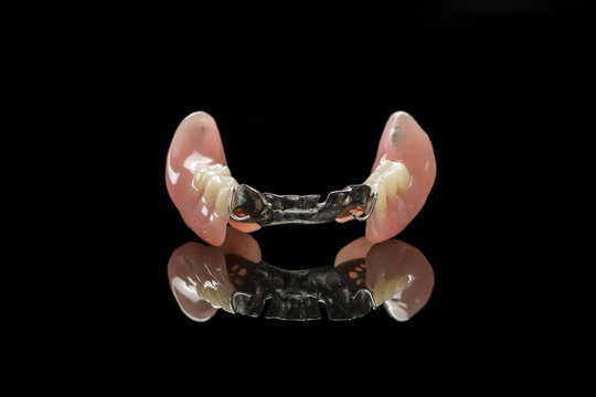 Removable partial denture