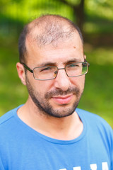 portrait of young man with bad eyesight and hair loss.