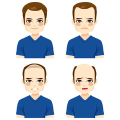 Fototapeta premium Young male with different stages of hair loss