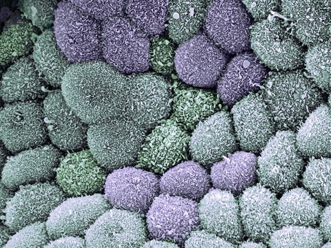 Gall bladder surface, SEM