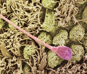 Sperm cell, SEM