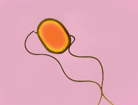 Salmonella bacterium, TEM
