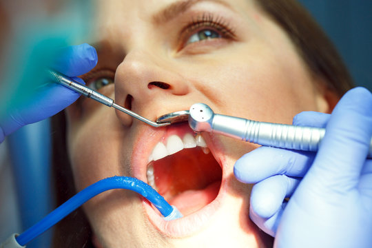 Woman getting a dental treatment