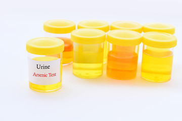 Urine sample for arsenic (Heavy metals) test
