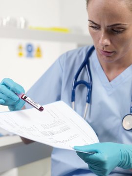 Doctor checking a blood sample