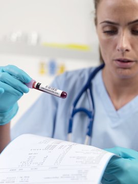 Doctor checking a blood sample