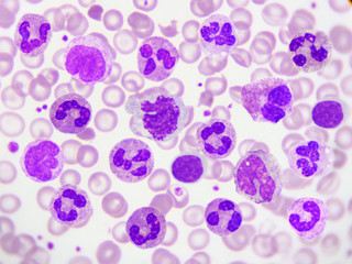 White blood cells in peripheral blood smear, Wright stain