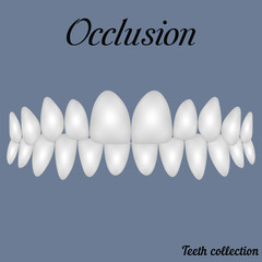 occlusion clenched teeth © brovarky