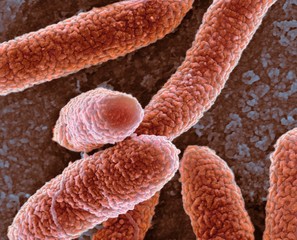 E coli bacteria, SEM