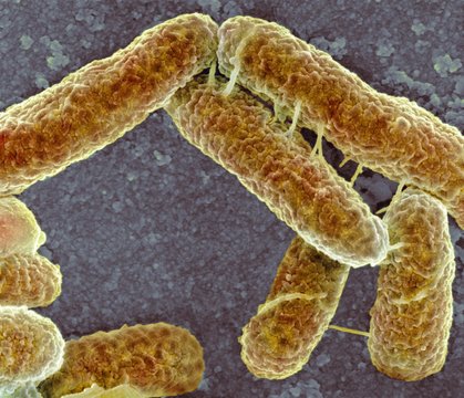 E coli bacteria, SEM