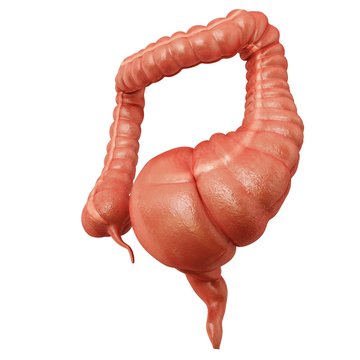 Megacolon, illustration