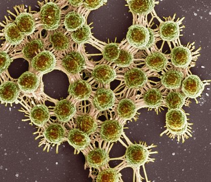 Saliva and bacteria, SEM