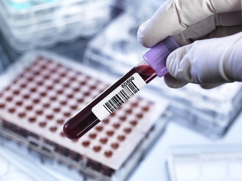 Blood testing