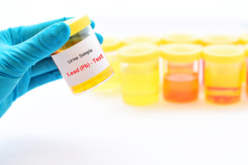 Urine sample for lead (Pb) test

