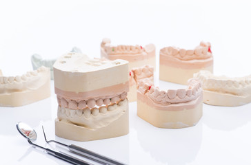 Teeth molds with basic dental tools on a bright white table