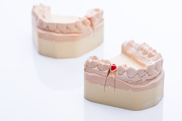 Obraz na płótnie Canvas Teeth molds on a bright white table