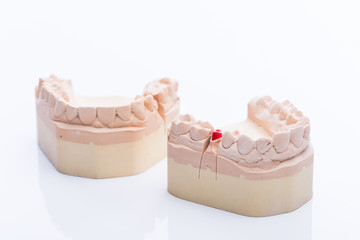 Teeth molds on a bright white table