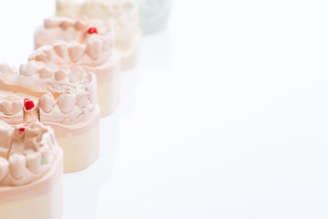 Teeth molds on a bright white table