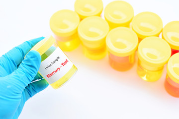 Urine sample for Mercury (Hg) test
