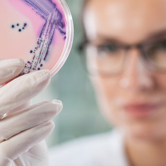 Microbiologist holding a Petri dish with bacteria
