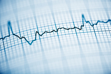 Electrocardiogram