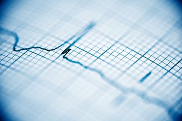 Electrocardiogram