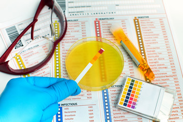 hand holding test ph of sample urine on petri dish and analysis /Urianalysis. ph test, urine sample in tube, Medical report, petri dish, and forms 
