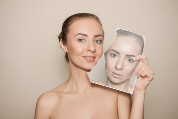 before and after beauty procedure