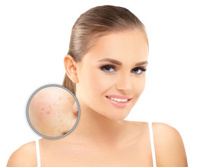 Portrait of beautiful girl  with problem and clear skin 