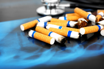 Cigarettes and stethoscope on x-ray lung, close up