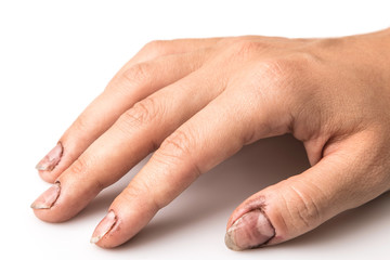Female hands with dirty nails