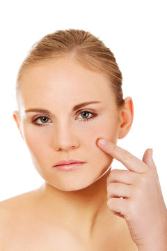 Unhappy young woman touching her pimple