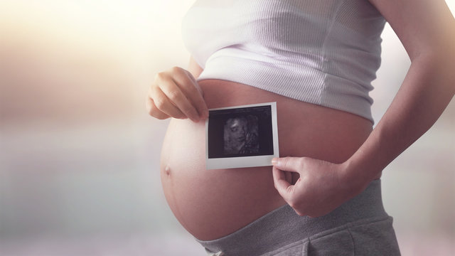 woman holding ultrasound scan