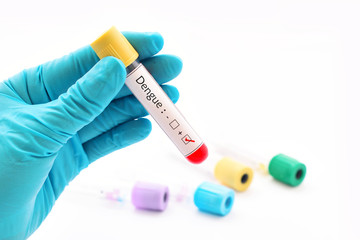 Blood sample positive with dengue virus