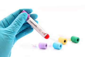 Blood sample positive with legionella