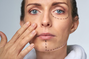 Perforation drawing lines on woman's face before procedure