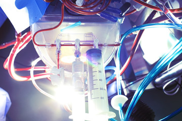 Medical equipment with tubes of blood and solutions