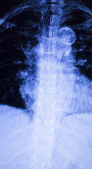 Spine back neck xray scan