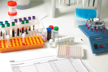 desktop laboratory medical equipment for blood tests and the results of cbc