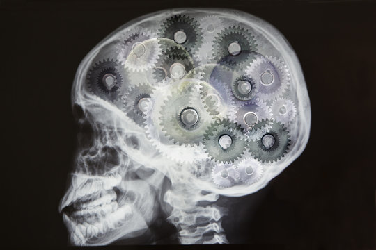 X-ray of skull with cogs as brain, digital montage