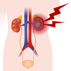 Inflammation of the kidney, human urinary organs, heart, kidney, bladder, vector illustration