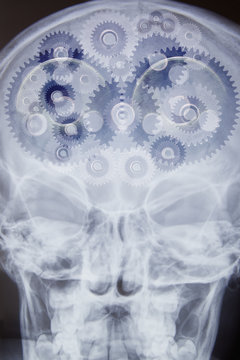 X-ray of skull with cogs as brain, digital montage