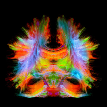 Full brain tractography with artistic color. This is a full brain tracking coming from a super-resolution reconstruction of 0.6 cubic mm. Front view.