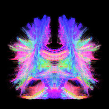 Full Brain Tractography With Artistic Color. This Is A Full Brain Tracking Coming From A Super-resolution Reconstruction Of 0.6 Cubic Mm. Front View