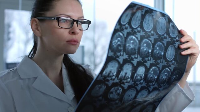 Female doctor viewing mri brain scan still shot