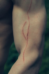 Fototapeta premium Abrasion on muscular hand