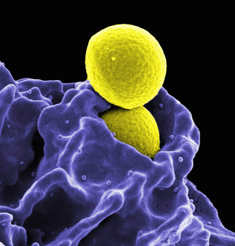 Colorized SEM of two spherical methicillin-resistant Staphylococcus aureus (MRSA) bacteria (yellow) in the process of being phagocytized by a human neutrophil white blood cell (blue)