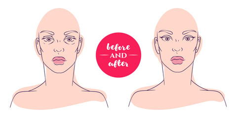 Obraz premium Portrait of a woman before and after with cosmetic defects. 