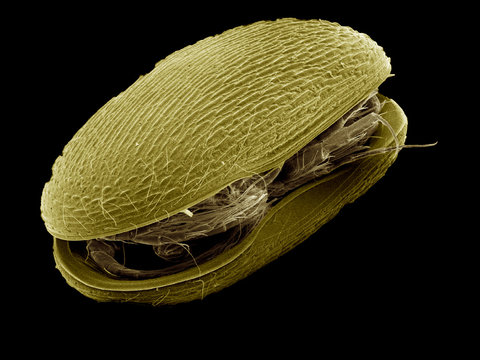 Ostracoda SEM