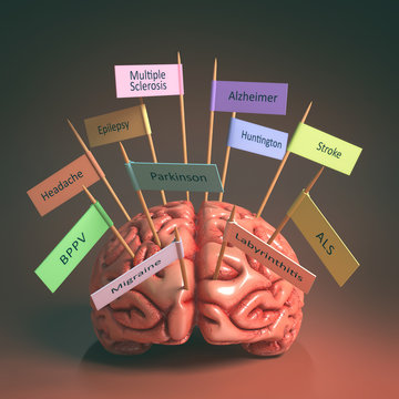 Image of a brain on the table with various nameplates of various diseases that can affect our brain. It's a 3D image with nameplates stuck by toothpick. Clipping path included.